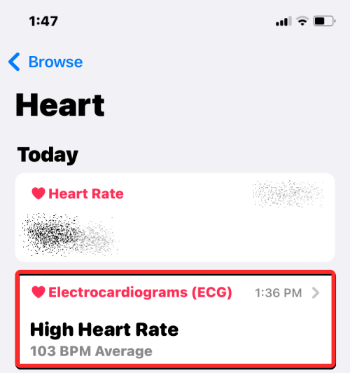 Apple Watch에 ECG 기록: 단계별 가이드