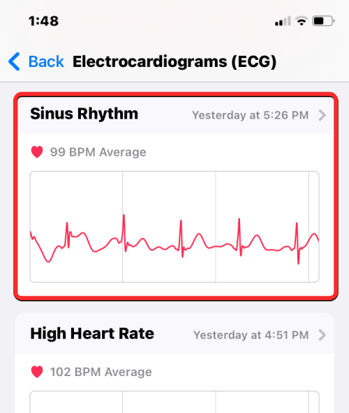 Apple Watch에 ECG 기록: 단계별 가이드