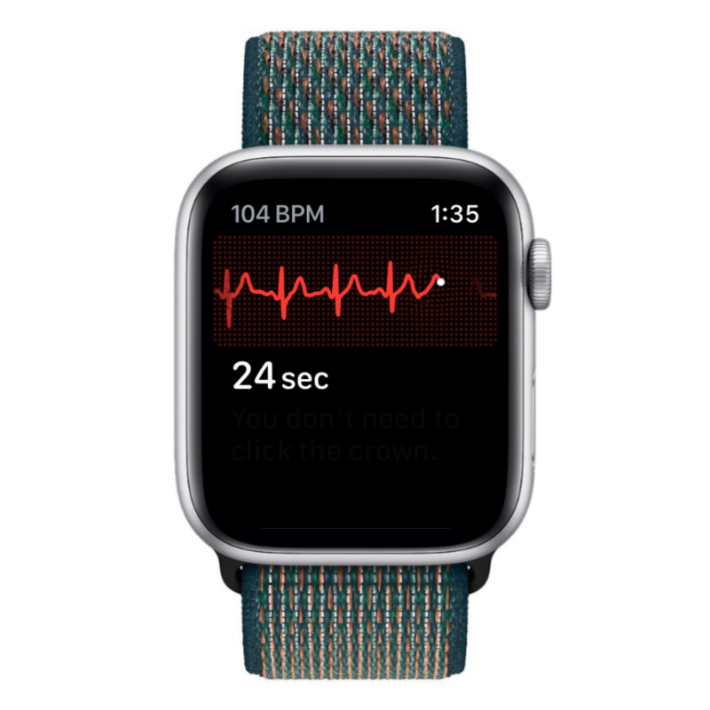 Apple Watch에 ECG 기록: 단계별 가이드