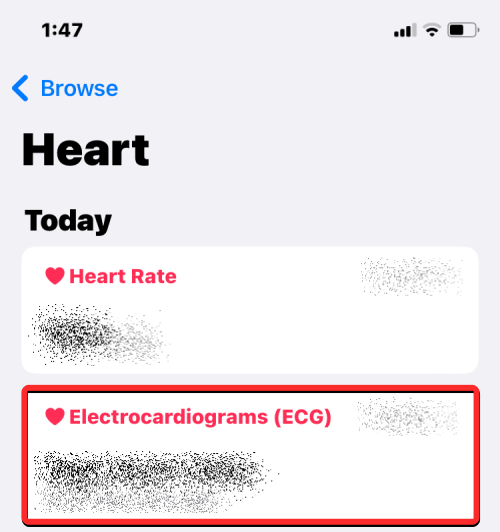 Apple Watch에 ECG 기록: 단계별 가이드