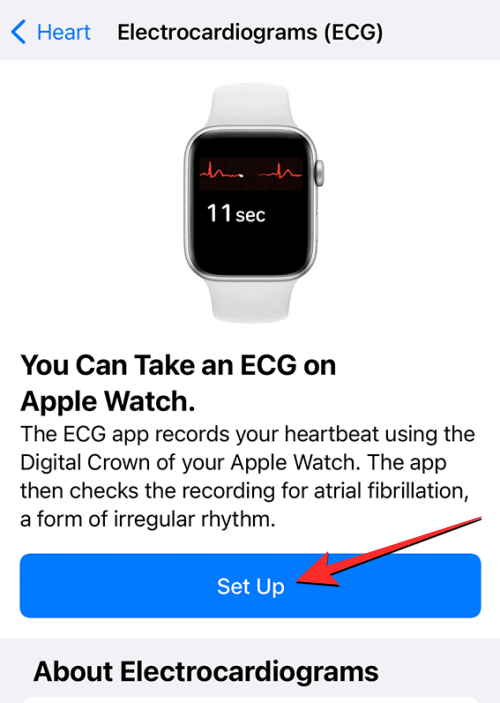 Apple Watch에 ECG 기록: 단계별 가이드