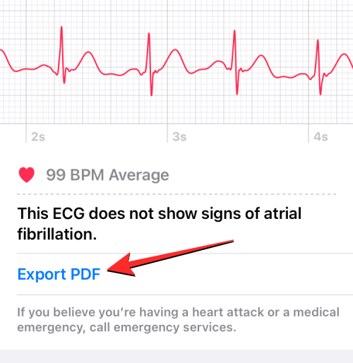 Apple Watch에 ECG 기록: 단계별 가이드