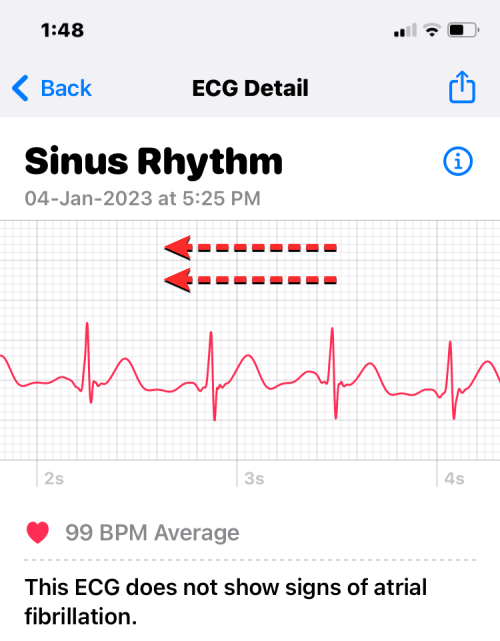 Apple Watch에 ECG 기록: 단계별 가이드