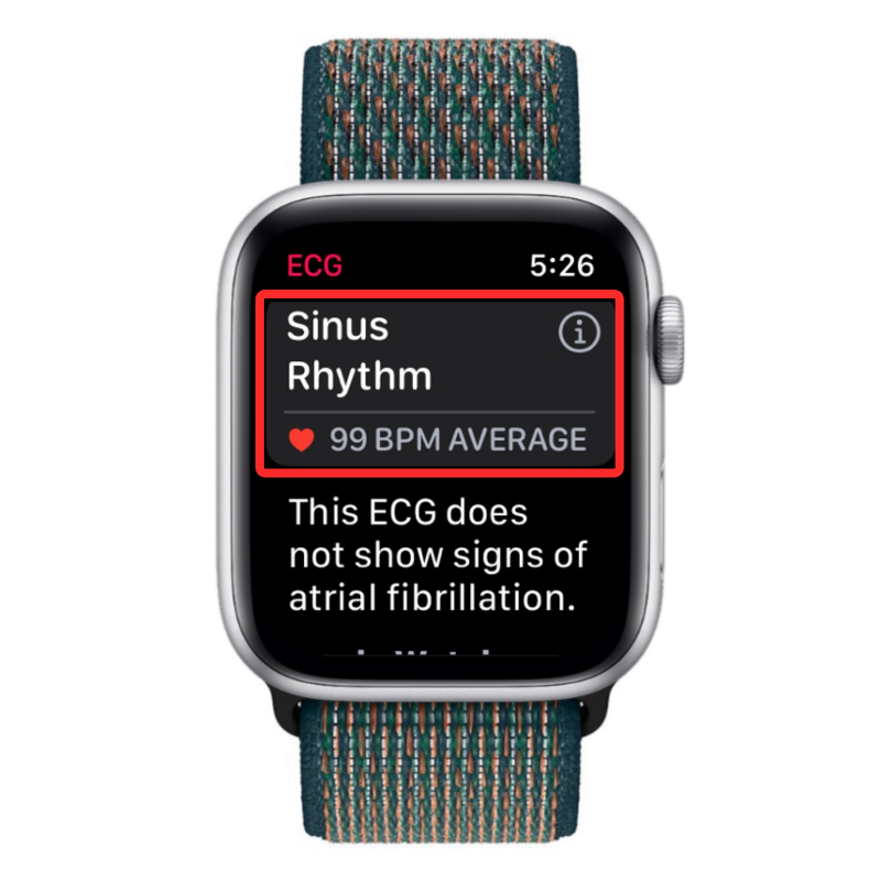 Apple Watch에 ECG 기록: 단계별 가이드