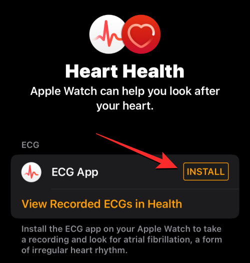 Apple Watch에 ECG 기록: 단계별 가이드