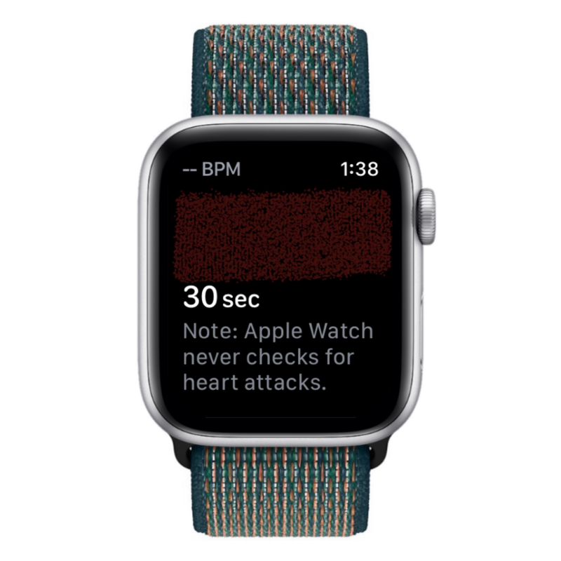 Apple Watch에 ECG 기록: 단계별 가이드