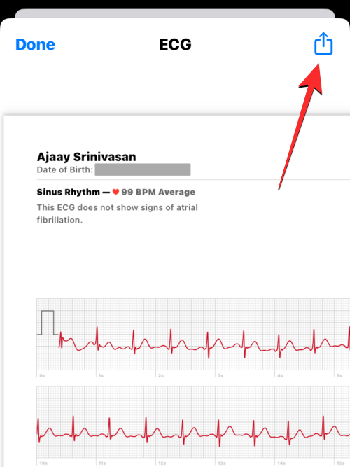 Apple Watch에 ECG 기록: 단계별 가이드