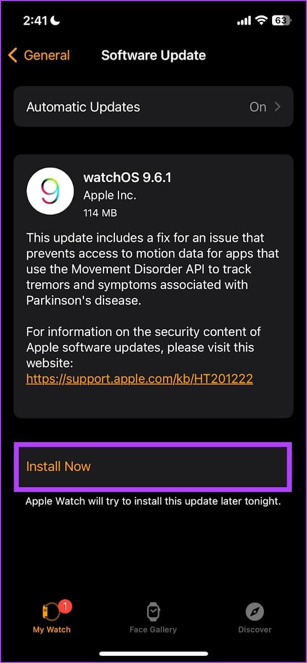 Diez formas de reparar el agotamiento de la batería del Apple Watch después de la actualización de watchOS 10