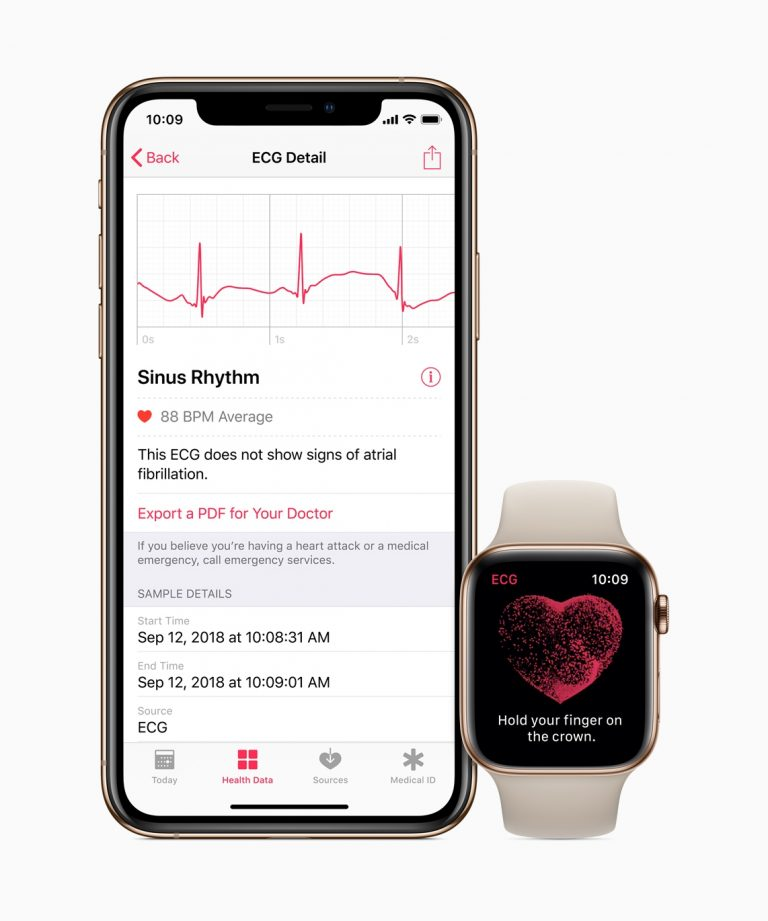 Cara Menggunakan Apl ECG Pada Siri 4 Apple Watch